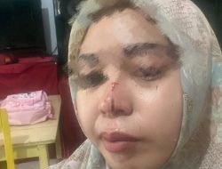 Wanita di Marikurubu Dipukul Paman Gara-Gara Sengketa Tanah, Hidung Pecah di Tempat