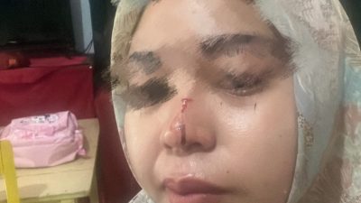Wanita di Marikurubu Dipukul Paman Gara-Gara Sengketa Tanah, Hidung Pecah di Tempat