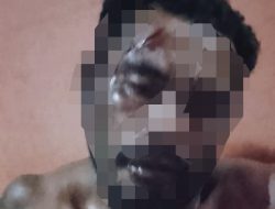 Tak Terima Dianiaya, Korban Pengeroyokan di Desa Bisui Segera Laporkan Pelaku ke Polsek Gane Timur
