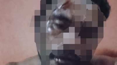 Tak Terima Dianiaya, Korban Pengeroyokan di Desa Bisui Segera Laporkan Pelaku ke Polsek Gane Timur